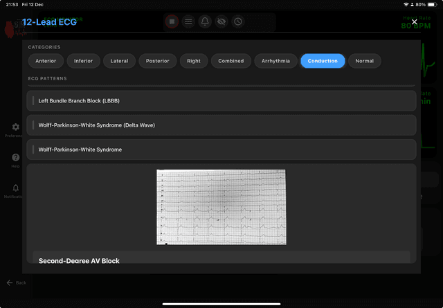 ActivSim Interface 3